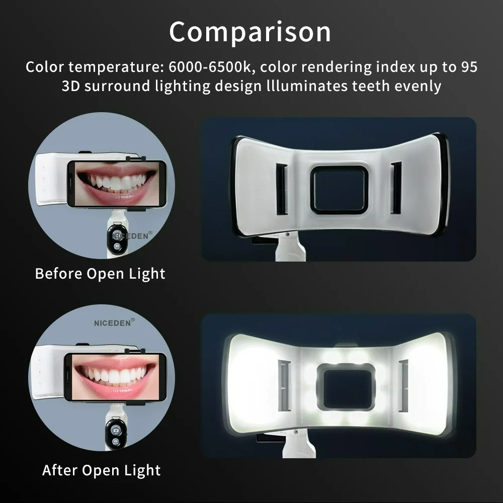 Dental Photography Light Phone - Photography Dental review and price