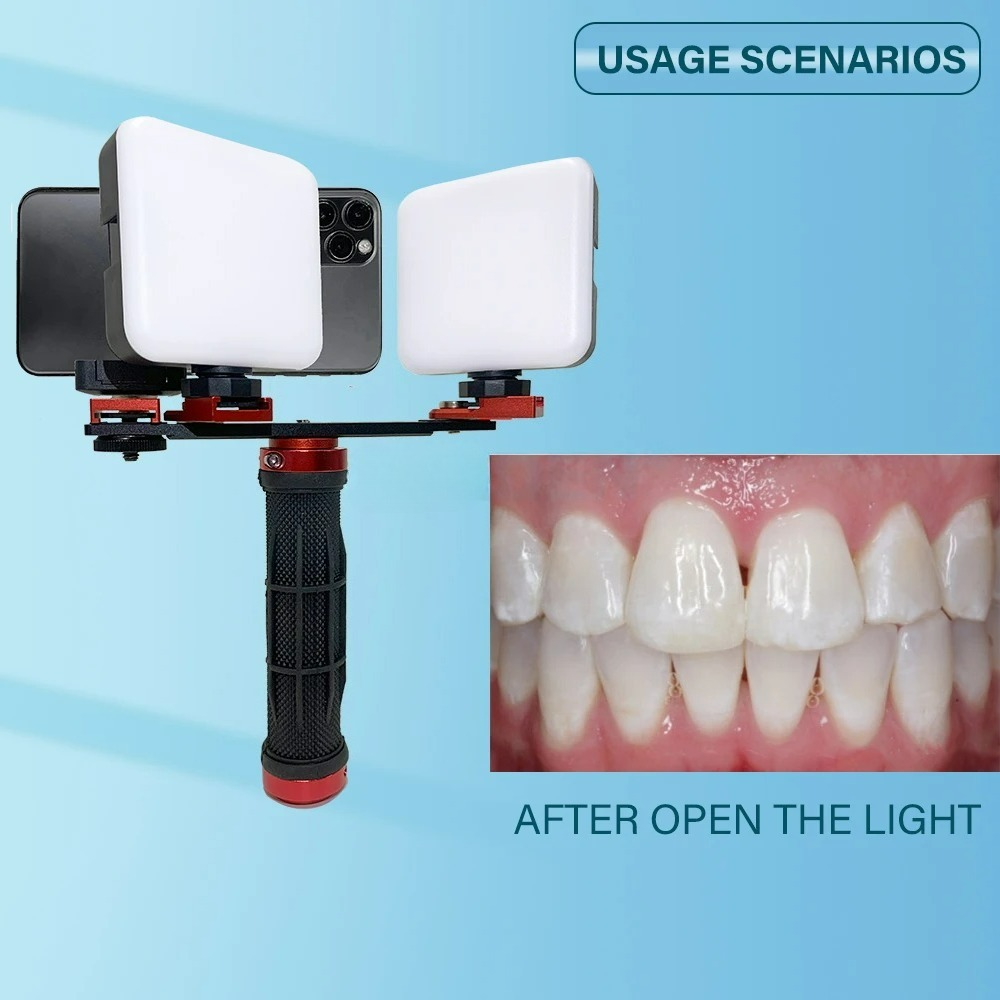 Dental Photography Light Phone - Photography Dental review and price