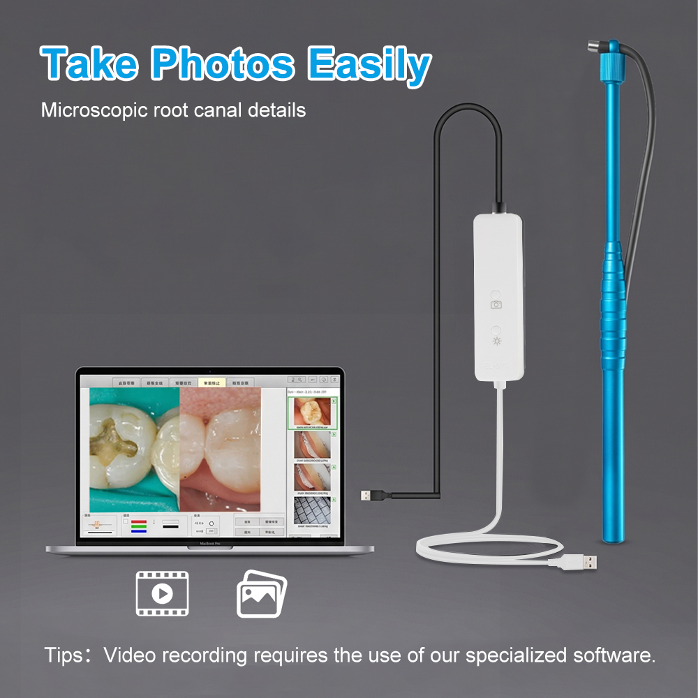 5MP Micro Intraoral Camera Den - Photography Dental review and price