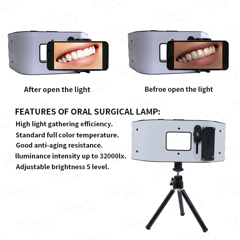 Dental Flash Light Photography - Photography Dental review and price
