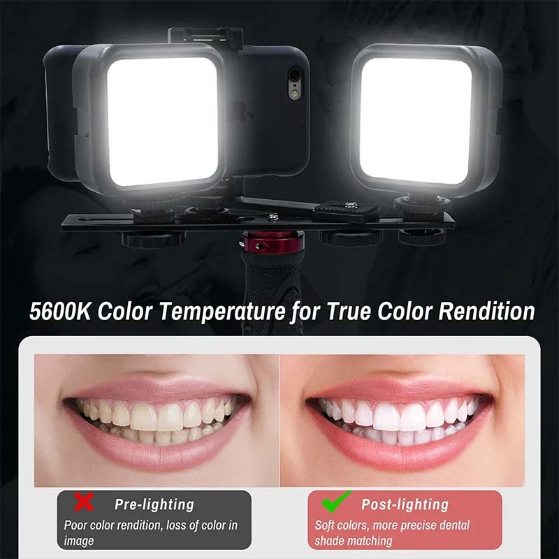 Dental Photography Light With  - Photography Dental review and price